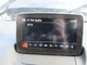 Info-GPS-TV Screen Fits 18-22 MAZDA CX-3 1022119